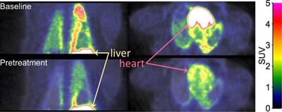 Proof of lung muscarinic receptor occupancy by tiotropium: Translational Positron Emission Tomography studies in non-human primates and humans